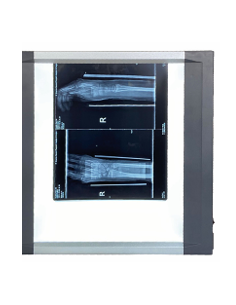 Négatoscope DevaToscope...